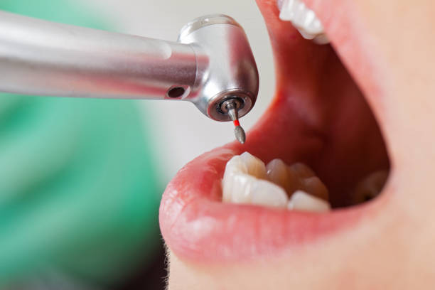 Best Urgent Tooth Repair  in Forest Lake, MN